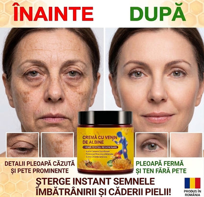Cremā cu venin de albine- frumusete