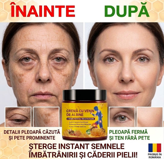 Cremā cu venin de albine- frumusete