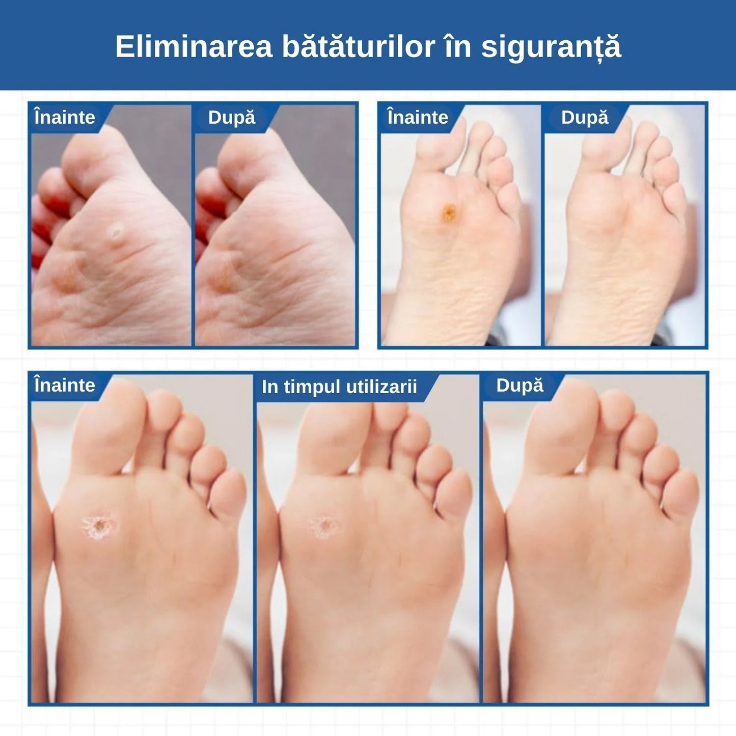 Plasturi pentru bǎtaturi şi negi