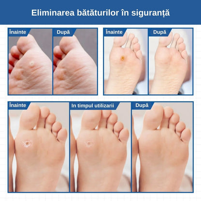 Plasturi pentru bǎtaturi şi negi