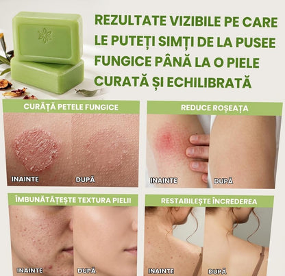 Sapun antifungic