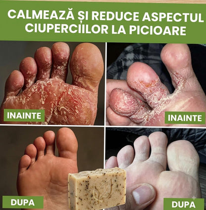 Sapun antifungic